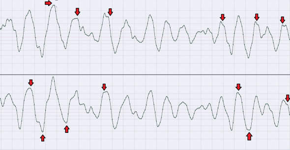 The advantages of composite clipping